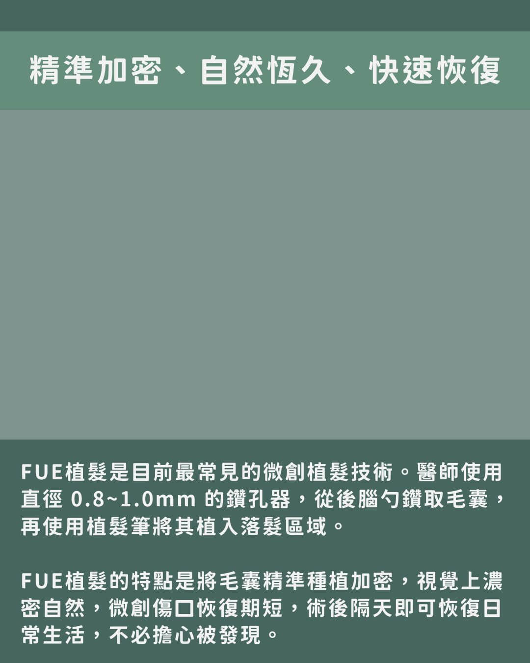 精準加密、自然恆久、快速恢復