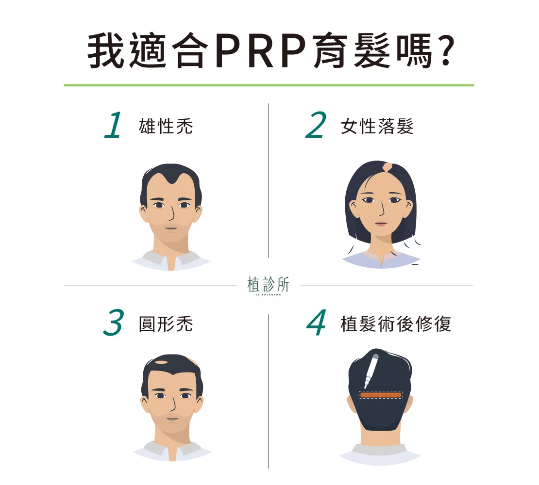 PRP育髮適合對象