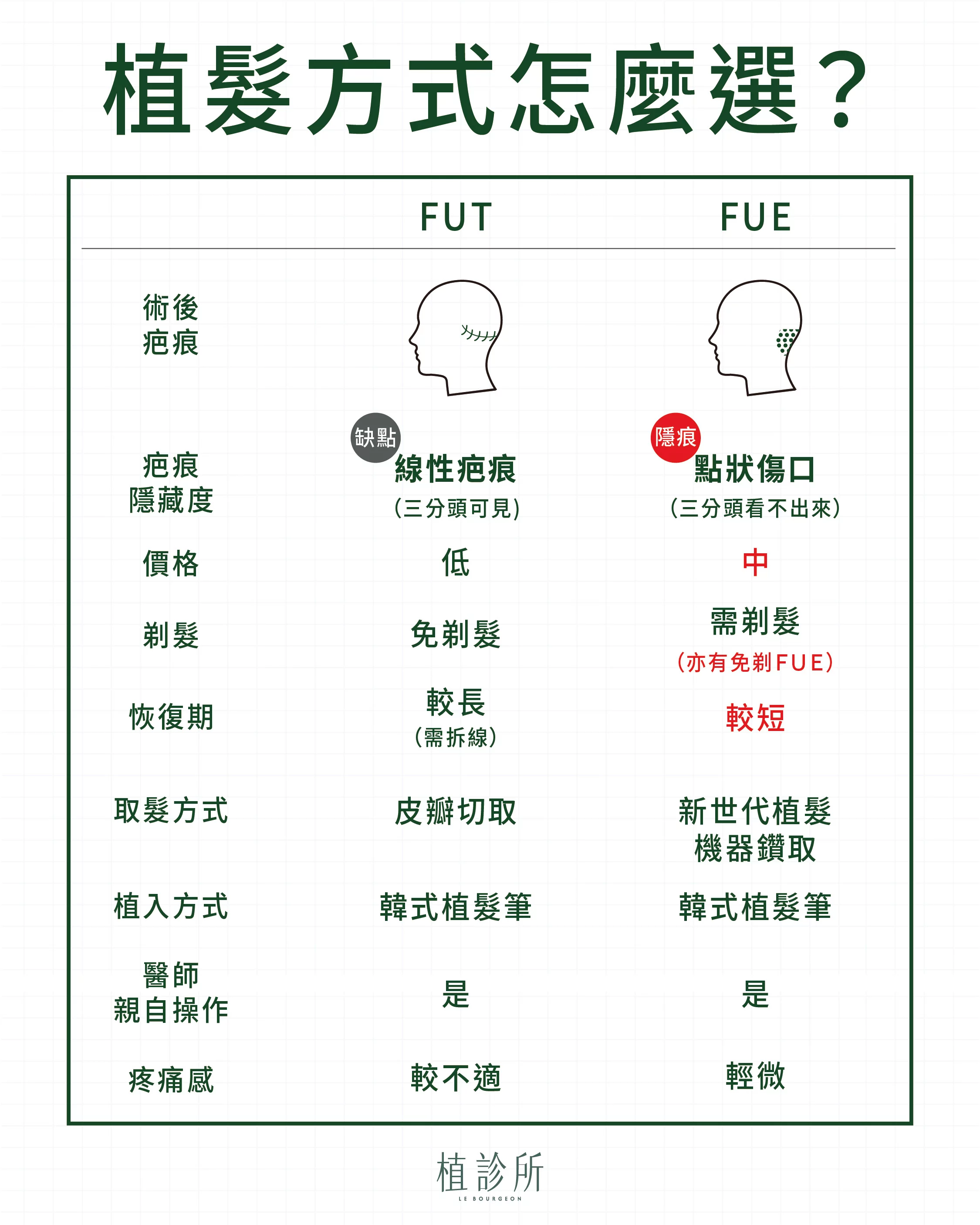 植髮方式怎麼選