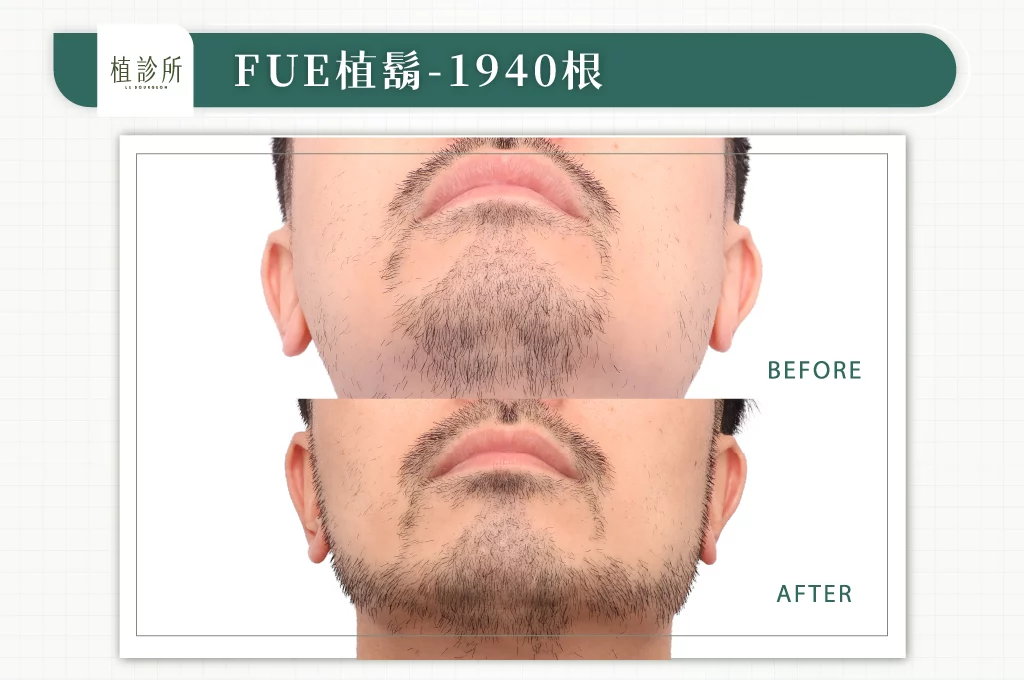 20260106 BA圖 官網醫生案例