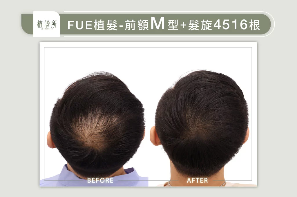 20260119 W 官網大標 4大標髮旋