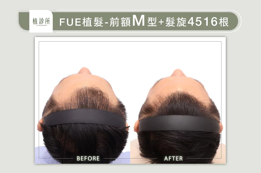 20260119 W 官網大標 5大標前額