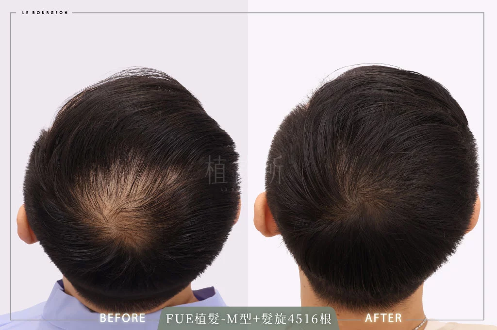 20260119 ｗ 官網大標 1髮旋