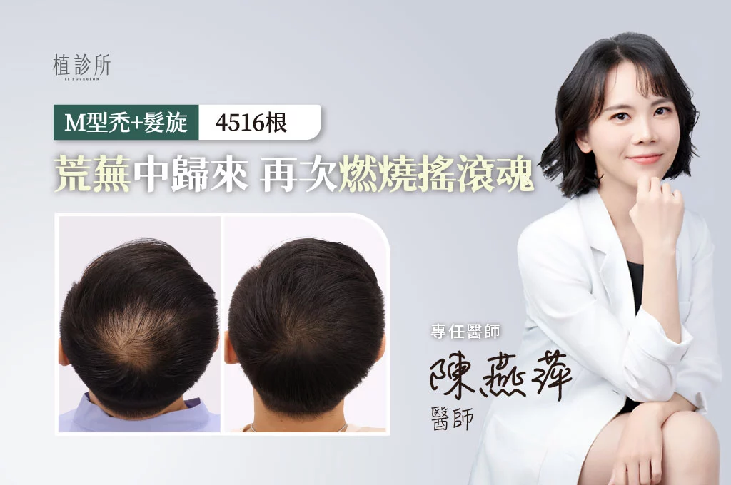 2026 植髮案例官網封面 Ww