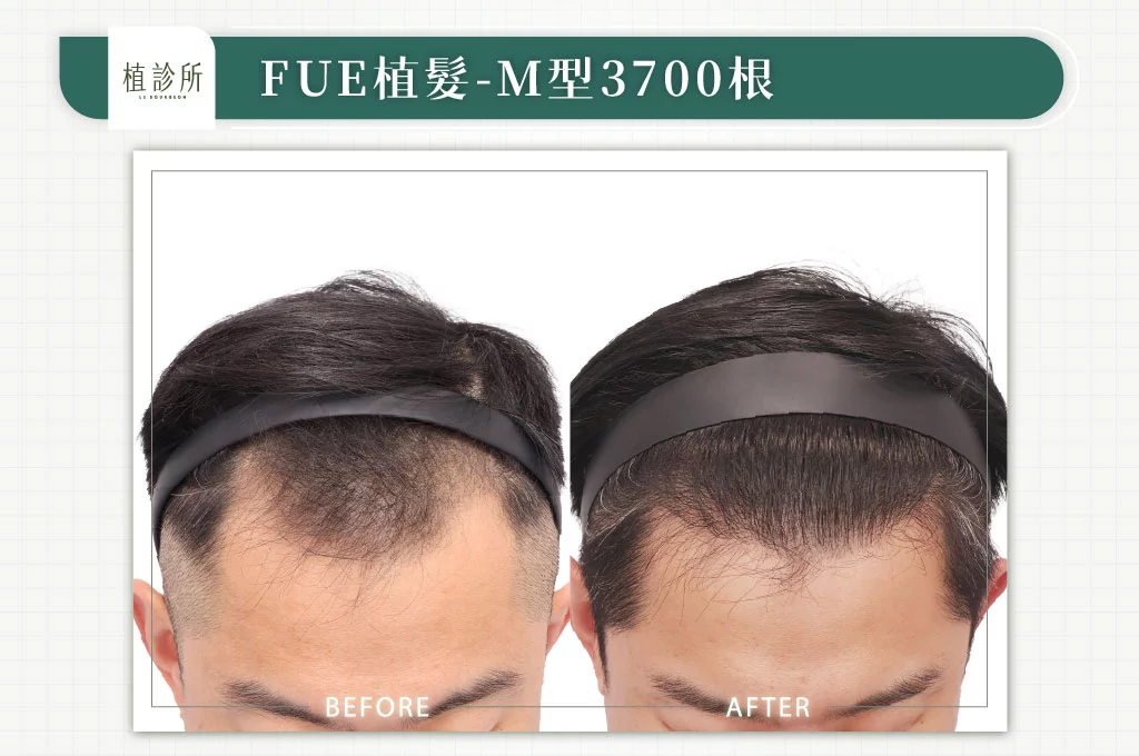 20260309 大標 4大標髮旋