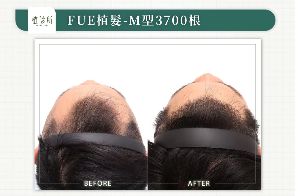 20260309 官網大標 5大標前額