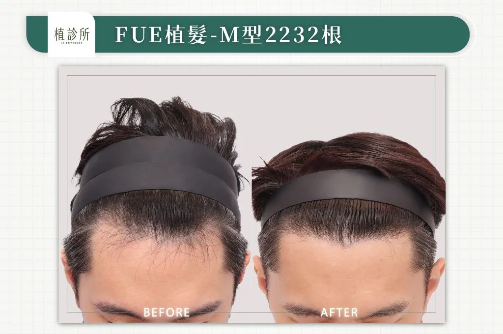 20260316 官網大標 4大標髮旋