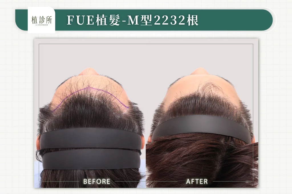 20260316 官網大標 5大標前額