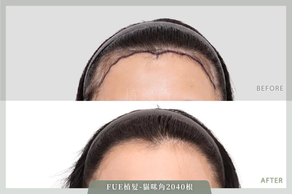 2026031 L 官網大標 1正面