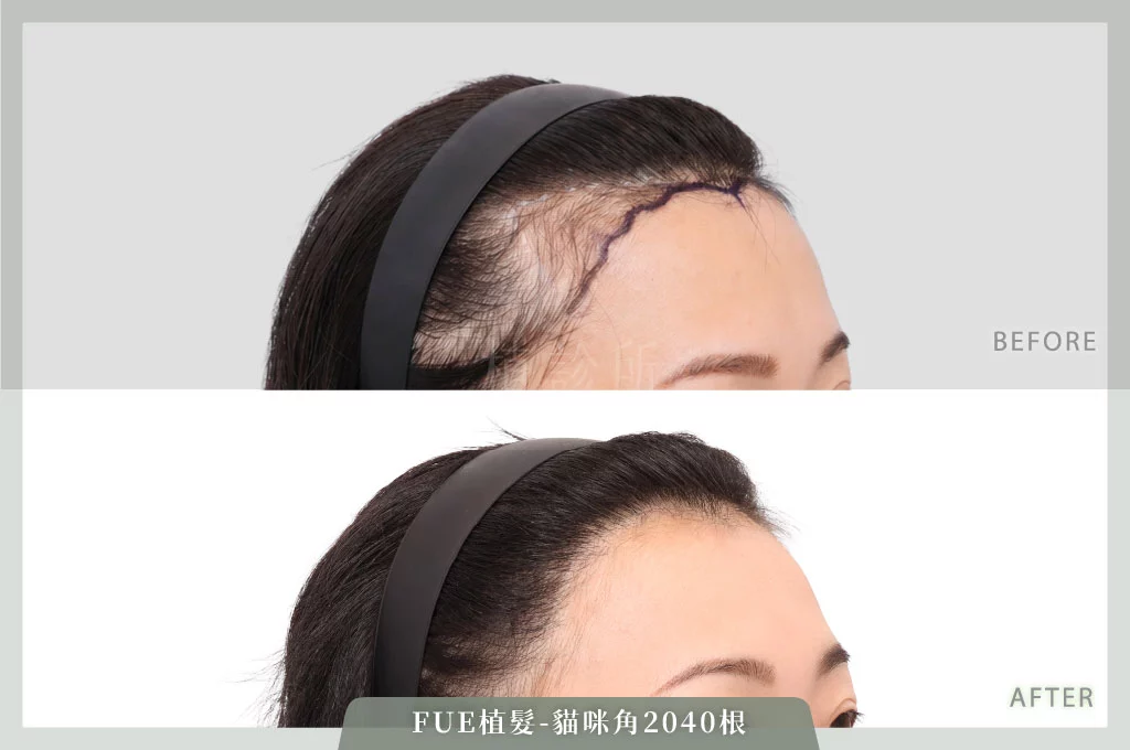 2026031 L 官網大標 3側面