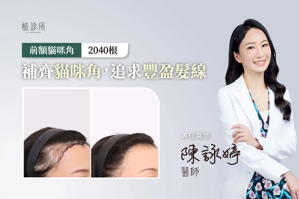 2026 植髮案例官網封面 L
