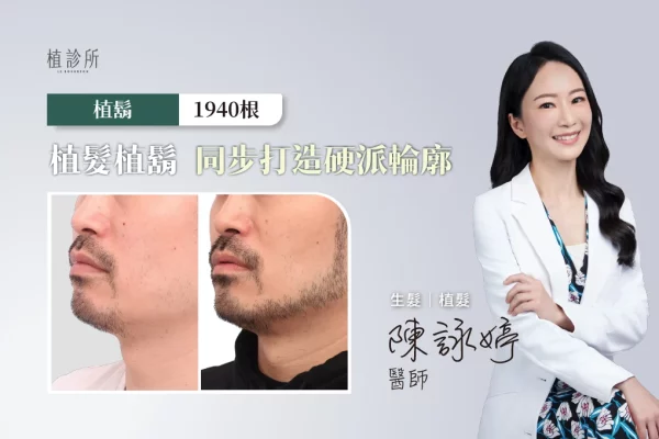 20260102 FUE 植鬍 1940根 封面