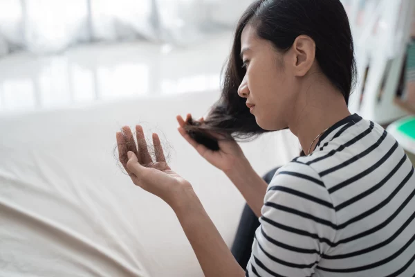 掉髮女性
