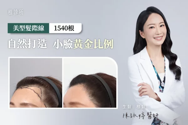美型髮際線
